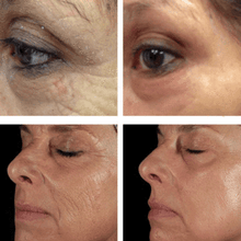 Load image into Gallery viewer, APPAREIL ANTI-ÂGE PAR TRAITEMENT LED - 5 EN 1 (NOUVEAUTÉ 2019)