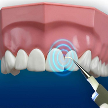 Load image into Gallery viewer, Multi-functional Sonic LED Dental Stain Eraser Tooth Cleaning Whitener
