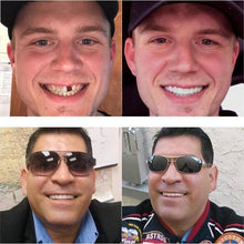 Load image into Gallery viewer, *Limited Supply-THE AMAZING PERFECT SMILE*
