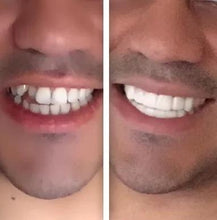 Load image into Gallery viewer, *Limited Supply-THE AMAZING PERFECT SMILE*

